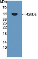 CDH3 / P-Cadherin Antibody - Western Blot; Sample: Recombinant CDHP, Human.
