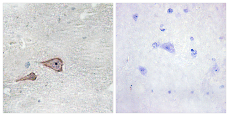 CDH3 / P-Cadherin Antibody - Immunohistochemistry analysis of paraffin-embedded human brain tissue, using CDH3 Antibody. The picture on the right is blocked with the synthesized peptide.