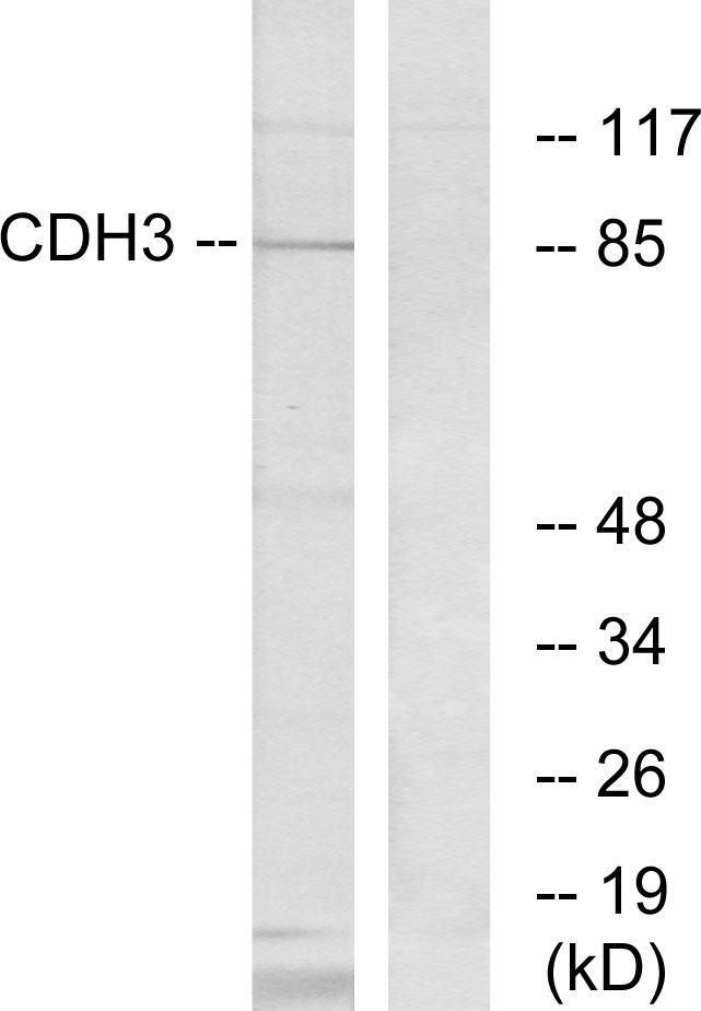 CDH3 / P-Cadherin Antibody - Western blot analysis of lysates from K562 cells, using CDH3 Antibody. The lane on the right is blocked with the synthesized peptide.