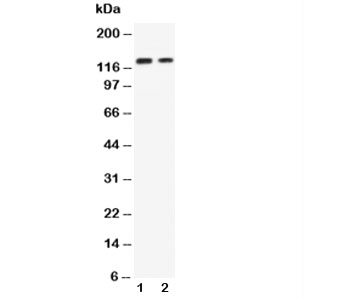 CDH3 / P-Cadherin Antibody - Western blot testing of P-Cadherin antibody and Lane 1: recombinant human protein 10ng; 2: 5ng