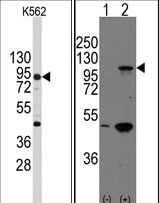 CDH3 / P-Cadherin Antibody - Western blot of anti-CDH3 Antibody in K562 cell line lysates (35 ug/lane). CDH3(arrow) was detected using the purified antibody. Western blot of CDH3 (arrow) using rabbit polyclonal CDH3 Antibody. 293 cell lysates (2 ug/lane) either nontransfected (Lane 1) or transiently transfected with the CDH3 gene (Lane 2) (Origene Technologies).
