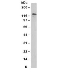 CDH3 / P-Cadherin Antibody - Western blot testing of human A431 cell lysate with P-Cadherin / CDH3 antibody (clone 12H6). Expected molecular weight: ~91 kDa (unmodified), 100~130 kDa (glycosylated).