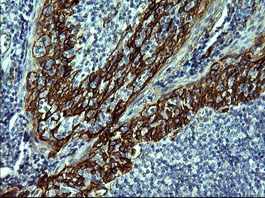 CDH3 / P-Cadherin Antibody - IHC of paraffin-embedded Human lymph node tissue using anti-CDH3 mouse monoclonal antibody. (Heat-induced epitope retrieval by 10mM citric buffer, pH6.0, 120°C for 3min).