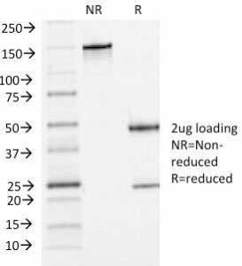 CDH3 / P-Cadherin Antibody - SDS-PAGE Analysis of Purified, BSA-Free P-Cadherin Antibody (clone 6A9). Confirmation of Integrity and Purity of the Antibody.