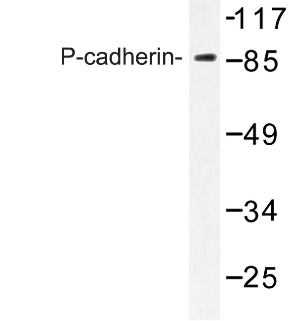 CDH3 / P-Cadherin Antibody - Western blot of P-cadherin (G78) pAb in extracts from K562 cells.