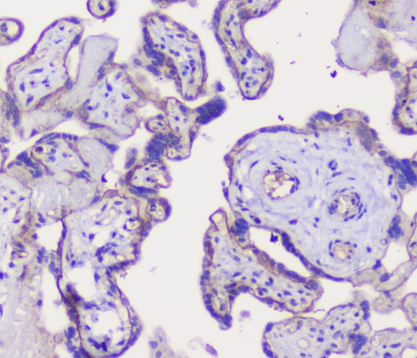 CDH3 / P-Cadherin Antibody - IHC analysis of P cadherin using anti-P cadherin antibody. P cadherin was detected in paraffin-embedded section of human placenta tissue. Heat mediated antigen retrieval was performed in citrate buffer (pH6, epitope retrieval solution) for 20 mins. The tissue section was blocked with 10% goat serum. The tissue section was then incubated with 1µg/ml rabbit anti-P cadherin Antibody overnight at 4°C. Biotinylated goat anti-rabbit IgG was used as secondary antibody and incubated for 30 minutes at 37°C. The tissue section was developed using Strepavidin-Biotin-Complex (SABC) with DAB as the chromogen.