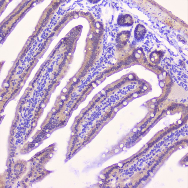 CDH3 / P-Cadherin Antibody - IHC analysis of P cadherin using anti-P cadherin antibody. P cadherin was detected in paraffin-embedded section of mouse intestine tissue. Heat mediated antigen retrieval was performed in citrate buffer (pH6, epitope retrieval solution) for 20 mins. The tissue section was blocked with 10% goat serum. The tissue section was then incubated with 1µg/ml rabbit anti-P cadherin Antibody overnight at 4°C. Biotinylated goat anti-rabbit IgG was used as secondary antibody and incubated for 30 minutes at 37°C. The tissue section was developed using Strepavidin-Biotin-Complex (SABC) with DAB as the chromogen.