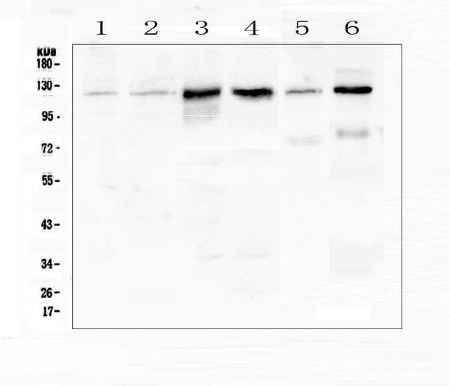 CDH3 / P-Cadherin Antibody - Western blot analysis of P cadherin using anti-P cadherin antibody. Electrophoresis was performed on a 5-20% SDS-PAGE gel at 70V (Stacking gel) / 90V (Resolving gel) for 2-3 hours. The sample well of each lane was loaded with 50ug of sample under reducing conditions. Lane 1: human Hela whole cell lysate,Lane 2: human K562 whole cell lysate,Lane 3: human A431 whole cell lysate,Lane 4: human Caco-2 whole cell lysate,Lane 5: rat brain tissue lysates,Lane 6: mouse brain tissue lysates. After Electrophoresis, proteins were transferred to a Nitrocellulose membrane at 150mA for 50-90 minutes. Blocked the membrane with 5% Non-fat Milk/ TBS for 1.5 hour at RT. The membrane was incubated with rabbit anti-P cadherin antigen affinity purified polyclonal antibody at 0.5 µg/mL overnight at 4°C, then washed with TBS-0.1% Tween 3 times with 5 minutes each and probed with a goat anti-rabbit IgG-HRP secondary antibody at a dilution of 1:10000 for 1.5 hour at RT. The signal is developed using an Enhanced Chemiluminescent detection (ECL) kit with Tanon 5200 system. A specific band was detected for P cadherin at approximately 120KD. The expected band size for P cadherin is at 91KD.