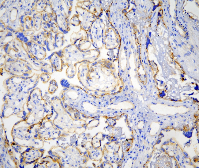 CDH3 / P-Cadherin Antibody - IHC analysis of P cadherin using anti-P cadherin antibody. P cadherin was detected in frozen section of human placenta tissues. Heat mediated antigen retrieval was performed in citrate buffer (pH6, epitope retrieval solution) for 20 mins. The tissue section was blocked with 10% goat serum. The tissue section was then incubated with 1µg/ml rabbit anti-P cadherin Antibody overnight at 4°C. Biotinylated goat anti-rabbit IgG was used as secondary antibody and incubated for 30 minutes at 37°C. The tissue section was developed using Strepavidin-Biotin-Complex (SABC) with DAB as the chromogen.