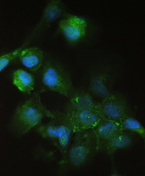 CDH3 / P-Cadherin Antibody - IF analysis of P cadherin using anti-P cadherin antibody P cadherin was detected in immunocytochemical section of A431 cell. Enzyme antigen retrieval was performed using IHC enzyme antigen retrieval reagent for 15 mins. The tissue section was blocked with 10% goat serum. The tissue section was then incubated with 2µg/mL rabbit anti-P cadherin Antibody overnight at 4°C. DyLight®488 Conjugated Goat Anti-Rabbit IgG was used as secondary antibody at 1:100 dilution and incubated for 30 minutes at 37°C. The section was counterstained with DAPI. Visualize using a fluorescence microscope and filter sets appropriate for the label used.