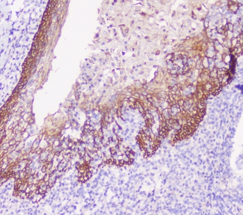 CDH3 / P-Cadherin Antibody - IHC staining of FFPE human tonsil with CDH3 antibody at 1ug/ml. HIER: boil tissue sections in pH6, 10mM citrate buffer, for 10-20 min followed by cooling at RT for 20 min.