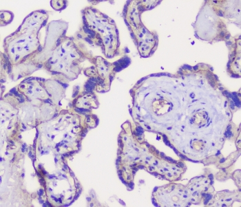 CDH3 / P-Cadherin Antibody - IHC staining of FFPE human placenta with CDH3 antibody at 1ug/ml. HIER: boil tissue sections in pH6, 10mM citrate buffer, for 10-20 min followed by cooling at RT for 20 min.