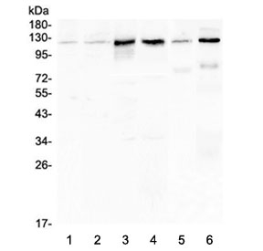 CDH3 / P-Cadherin Antibody - Western blot testing of human 1) HeLa, 2) K562, 3) A431, 4) Caco-2, 5) rat brain and 6) mouse brain lysate with CDH3 antibody at 0.5ug/ml. Expected molecular weight: ~91 kDa (unmodified), 100~130 kDa (glycosylated).