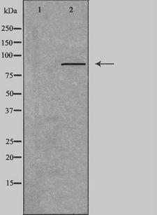 CDH3 / P-Cadherin Antibody - Western blot analysis of extracts of K562 cells using CDH3 antibody. The lane on the left is treated with the antigen-specific peptide.