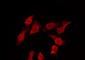 CDH3 / P-Cadherin Antibody - Staining HeLa cells by IF/ICC. The samples were fixed with PFA and permeabilized in 0.1% Triton X-100, then blocked in 10% serum for 45 min at 25°C. The primary antibody was diluted at 1:200 and incubated with the sample for 1 hour at 37°C. An Alexa Fluor 594 conjugated goat anti-rabbit IgG (H+L) Ab, diluted at 1/600, was used as the secondary antibody.