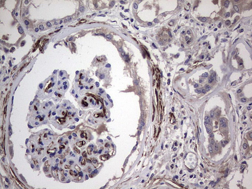 CDH4 / R Cadherin Antibody - Immunohistochemical staining of paraffin-embedded Human Kidney tissue within the normal limits using anti-CDH4 mouse monoclonal antibody. (Heat-induced epitope retrieval by 1 mM EDTA in 10mM Tris, pH8.5, 120C for 3min,