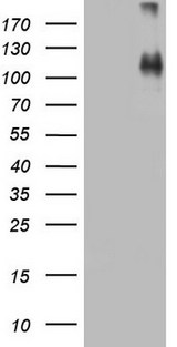 CDH4 / R Cadherin Antibody - HEK293T cells were transfected with the pCMV6-ENTRY control. (Left lane) or pCMV6-ENTRY CDH4. (Right lane) cDNA for 48 hrs and lysed. Equivalent amounts of cell lysates. (5 ug per lane) were separated by SDS-PAGE and immunoblotted with anti-CDH4.