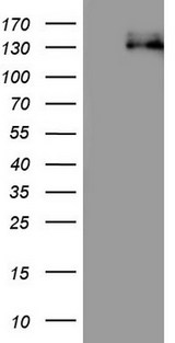 CDH4 / R Cadherin Antibody - HEK293T cells were transfected with the pCMV6-ENTRY control. (Left lane) or pCMV6-ENTRY CDH4. (Right lane) cDNA for 48 hrs and lysed. Equivalent amounts of cell lysates. (5 ug per lane) were separated by SDS-PAGE and immunoblotted with anti-CDH4.
