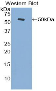 CDH4 / R Cadherin Antibody - Western blot of recombinant CDH4 / R Cadherin.  This image was taken for the unconjugated form of this product. Other forms have not been tested.