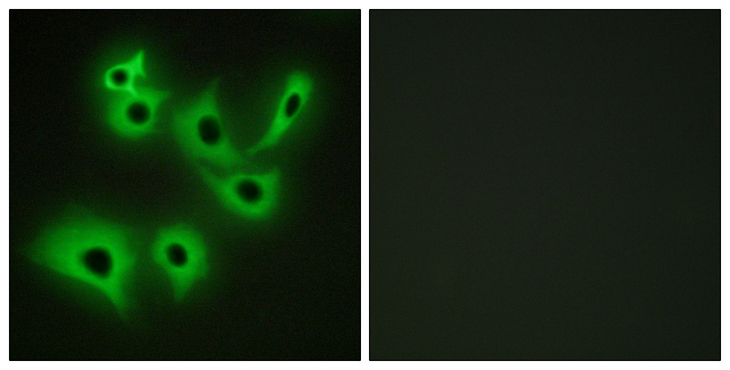 CDH4 / R Cadherin Antibody - Immunofluorescence analysis of A549 cells, using CDH4 Antibody. The picture on the right is blocked with the synthesized peptide.
