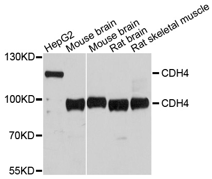 CDH4 / R Cadherin Antibody - Western blot analysis of extracts of various cell lines, using CDH4 antibody at 1:1000 dilution. The secondary antibody used was an HRP Goat Anti-Rabbit IgG (H+L) at 1:10000 dilution. Lysates were loaded 25ug per lane and 3% nonfat dry milk in TBST was used for blocking. An ECL Kit was used for detection and the exposure time was 10s.