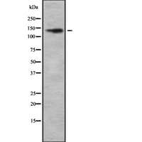 CDH4 / R Cadherin Antibody - Western blot analysis of CDH4 using Jurkat whole cells lysates