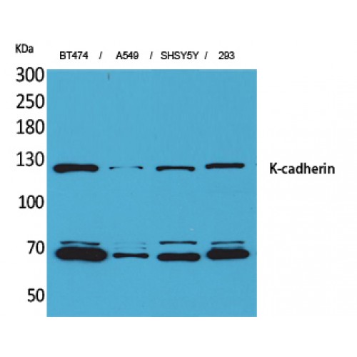 CDH6 / K Cadherin Antibody - Western blot of K-cadherin antibody
