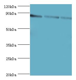 CDH6 / K Cadherin Antibody - Western blot. All lanes: CDH6 antibody at 6 ug/ml. Lane 1: 293T whole cell lysate. Lane 2: HeLa whole cell lysate. Lane 3: A549 whole cell lysate. Secondary antibody: Goat polyclonal to rabbit at 1:10000 dilution. Predicted band size: 88 kDa. Observed band size: 88 kDa Immunohistochemistry.