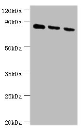 CDH6 / K Cadherin Antibody - Western blot All lanes: CDH6 antibody at 6µg/ml Lane 1: 293T whole cell lysate Lane 2: Hela whole cell lysate Lane 3: A549 whole cell lysate Secondary Goat polyclonal to rabbit IgG at 1/10000 dilution Predicted band size: 89, 74 kDa Observed band size: 89 kDa