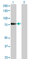 CDH6 / K Cadherin Antibody - Western Blot analysis of CDH6 expression in transfected 293T cell line by CDH6 monoclonal antibody (M05), clone 2F2.Lane 1: CDH6 transfected lysate(73.9 KDa).Lane 2: Non-transfected lysate.