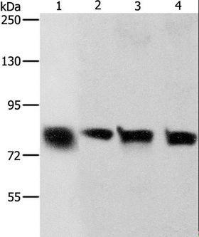 CDH6 / K Cadherin Antibody - Western blot analysis of HeLa and A549 cell, human liver cancer tissue and HT-29 cell, using CDH6 Polyclonal Antibody at dilution of 1:500.