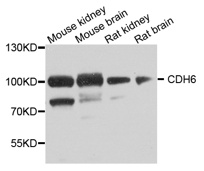 CDH6 / K Cadherin Antibody - Western blot analysis of extract of various cells.