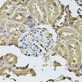 CDH6 / K Cadherin Antibody - Immunohistochemistry of paraffin-embedded rat kidney tissue.