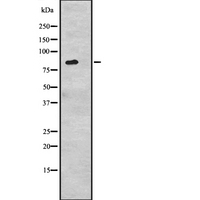 CDH6 / K Cadherin Antibody - Western blot analysis of CDH6 expression in 293 cells line lysates. The lane on the left is treated with the antigen-specific peptide.