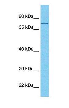 CDH6 / K Cadherin Antibody - Western blot of CADH6 Antibody with human Fetal Kidney lysate.  This image was taken for the unconjugated form of this product. Other forms have not been tested.