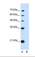CDH7 / Cadherin 7 Antibody - Lane A: Marker. Lane B: HepG2 cell lysate. Antibody concentration: 0.25 ug/ml. Gel concentration: 12%.  This image was taken for the unconjugated form of this product. Other forms have not been tested.