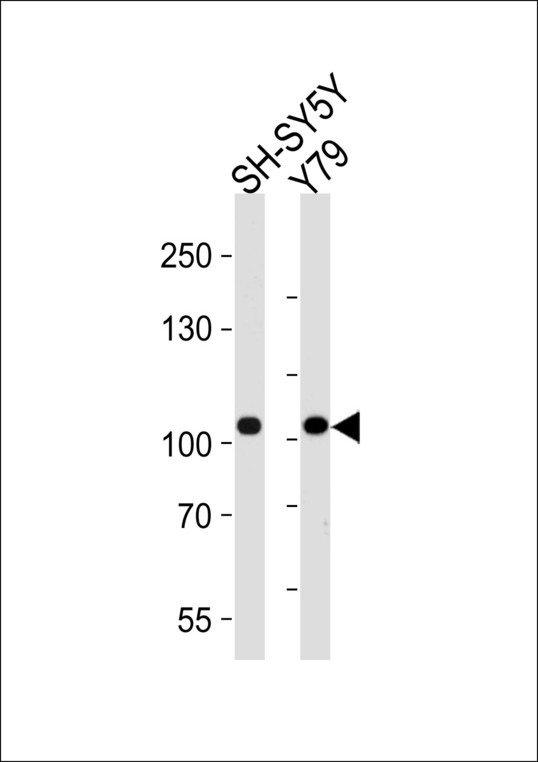 CDH8 / Cadherin 8 Antibody - Western blot of lysates from SH-SY5Y, Y79 cell line (from left to right), using CDH8 Antibody. Antibody was diluted at 1:1000 at each lane. A goat anti-rabbit IgG H&L (HRP) at 1:5000 dilution was used as the secondary antibody. Lysates at 35ug per lane.