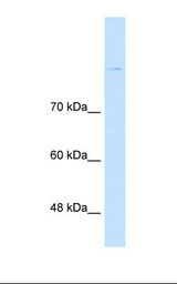 CDH8 / Cadherin 8 Antibody - Lane A: Marker. Lane B: Jurkat cell lysate. Antibody concentration: 1.0 ug/ml. Gel concentration: 8%.  This image was taken for the unconjugated form of this product. Other forms have not been tested.