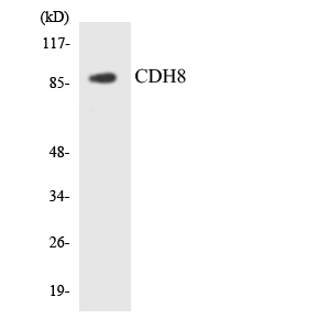 CDH8 / Cadherin 8 Antibody - Western blot analysis of the lysates from HeLa cells using CDH8 antibody.