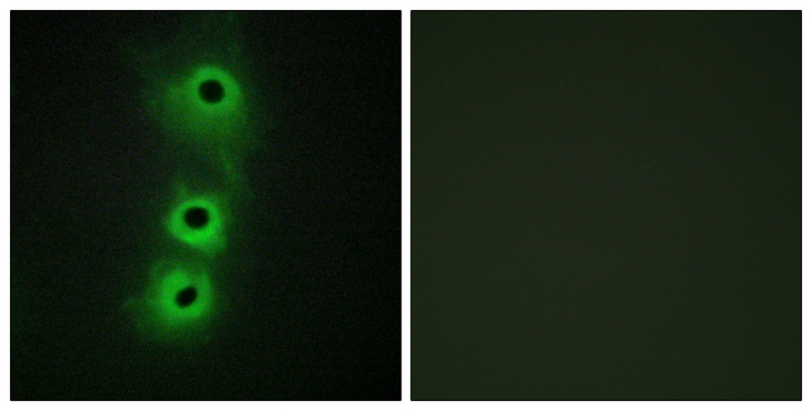 CDH8 / Cadherin 8 Antibody - Immunofluorescence analysis of COS7 cells, using CDH8 Antibody. The picture on the right is blocked with the synthesized peptide.