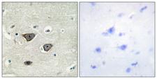 CDH8 / Cadherin 8 Antibody - Immunohistochemistry analysis of paraffin-embedded human brain tissue, using CDH8 Antibody. The picture on the right is blocked with the synthesized peptide.