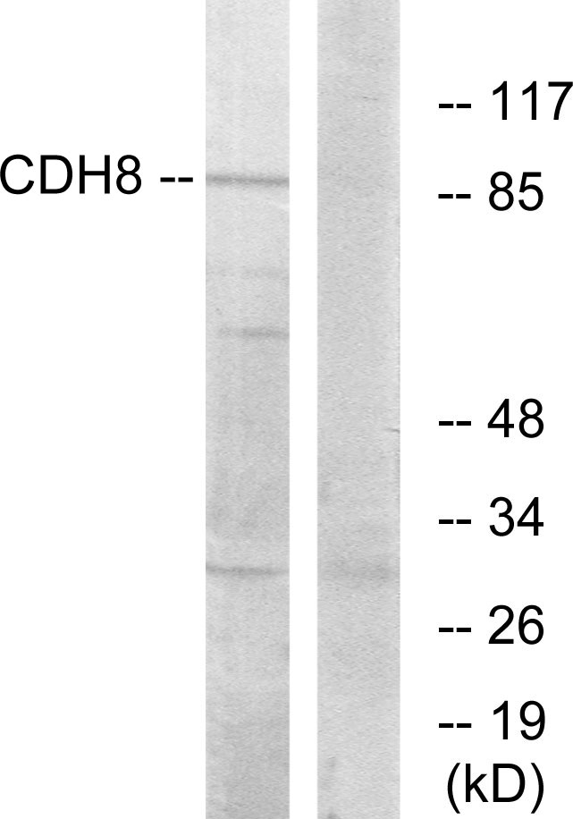 CDH8 / Cadherin 8 Antibody - Western blot analysis of lysates from RAW264.7 cells, using CDH8 Antibody. The lane on the right is blocked with the synthesized peptide.