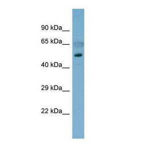CDH8 / Cadherin 8 Antibody - Western blot of Human Fetal Stomach. CDH8 antibody dilution 1.0 ug/ml.  This image was taken for the unconjugated form of this product. Other forms have not been tested.