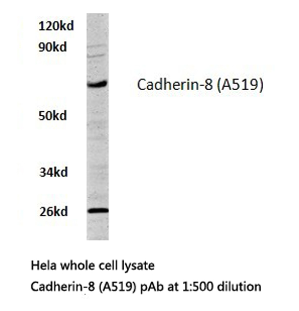 CDH8 / Cadherin 8 Antibody - Western blot of Cadherin-8 (A519) pAb in extracts from HeLa cells.