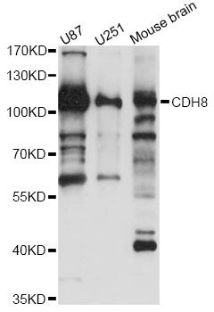CDH8 / Cadherin 8 Antibody - Western blot analysis of extracts of various cell lines, using CDH8 antibody at 1:3000 dilution. The secondary antibody used was an HRP Goat Anti-Rabbit IgG (H+L) at 1:10000 dilution. Lysates were loaded 25ug per lane and 3% nonfat dry milk in TBST was used for blocking. An ECL Kit was used for detection and the exposure time was 30s.