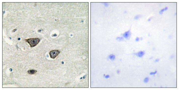 CDH8 / Cadherin 8 Antibody - Peptide - + Immunohistochemistry analysis of paraffin-embedded human brain tissue using CDH8 antibody.