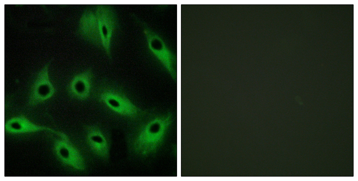 CDH9 / Cadherin 9 Antibody - Immunofluorescence analysis of HeLa cells, using CDH9 Antibody. The picture on the right is blocked with the synthesized peptide.