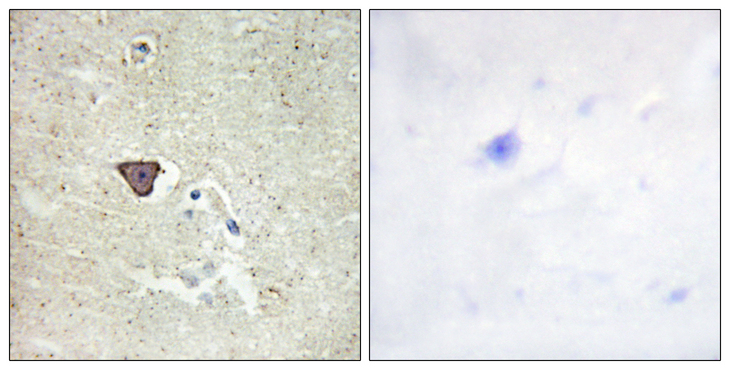 CDH9 / Cadherin 9 Antibody - Immunohistochemistry analysis of paraffin-embedded human brain tissue, using CDH9 Antibody. The picture on the right is blocked with the synthesized peptide.