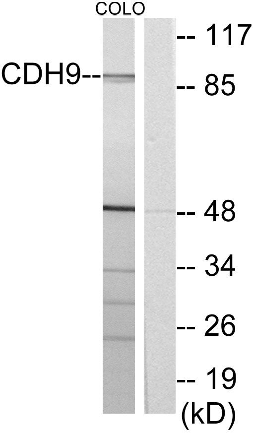 CDH9 / Cadherin 9 Antibody - Western blot analysis of lysates from COLO cells, using CDH9 Antibody. The lane on the right is blocked with the synthesized peptide.