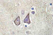 CDH9 / Cadherin 9 Antibody - Immunohistochemistry (IHC) analysis of Cadherin-9 (P222) pAb in paraffin-embedded human brain tissue.